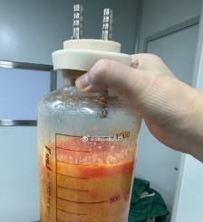 牡丹江水动力吸脂手术要做多久？
